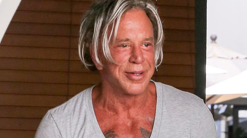 H selfie του Mickey Rourke με τον χειρουργό του, αμέσως μετά την πλαστική