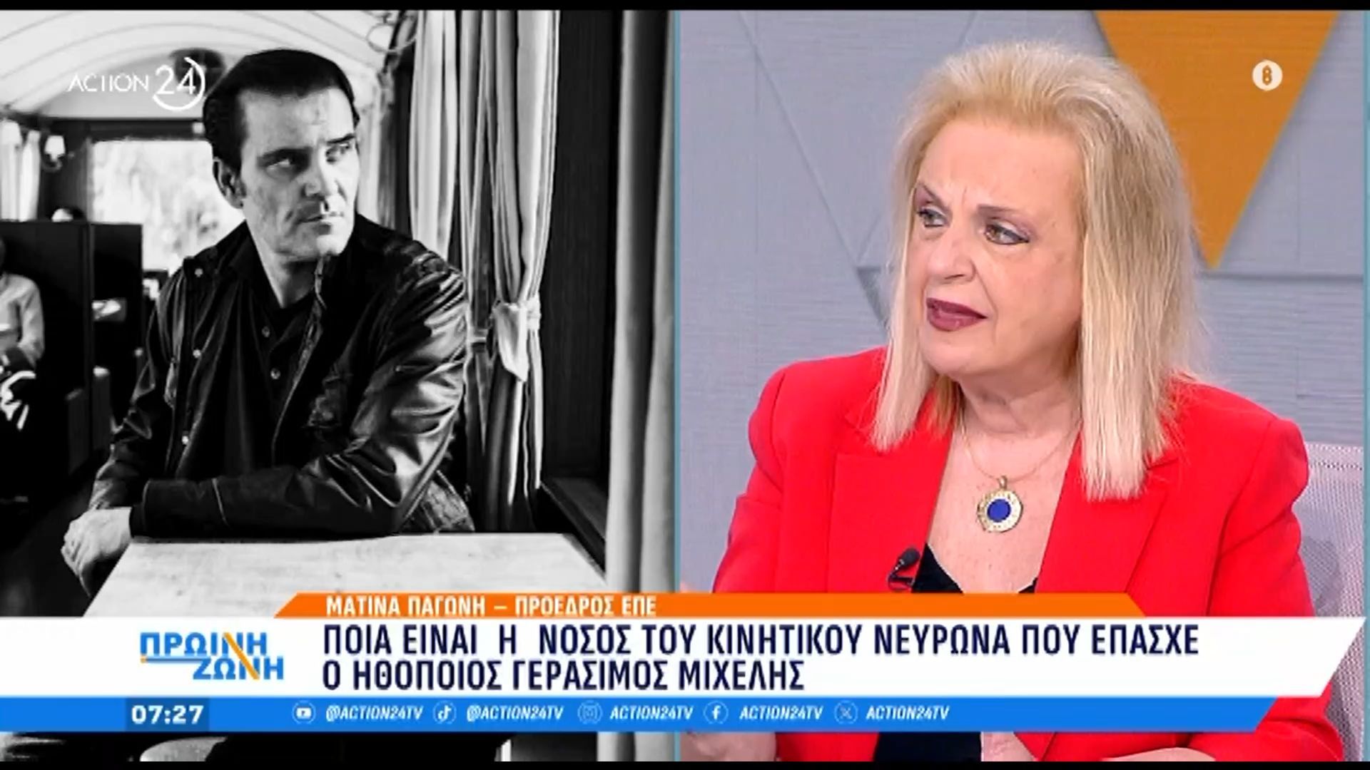 Τα αίτια θανάτου του Γ. Μιχελή - Ποιά είναι η νόσος του κινητικού νευρώνα 